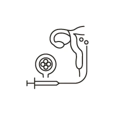 胚移植・凍結保存