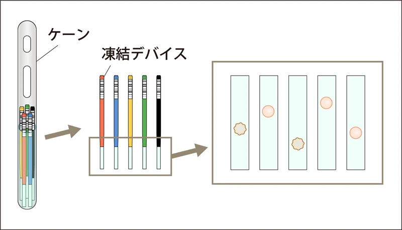 おち夢の卵子凍結【１個保存】